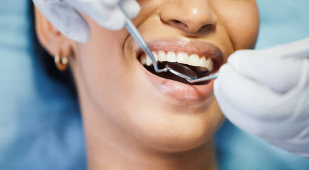 Best Emergency Cosmetic Dentistry (e.g., broken veneers) in La Paloma, TX