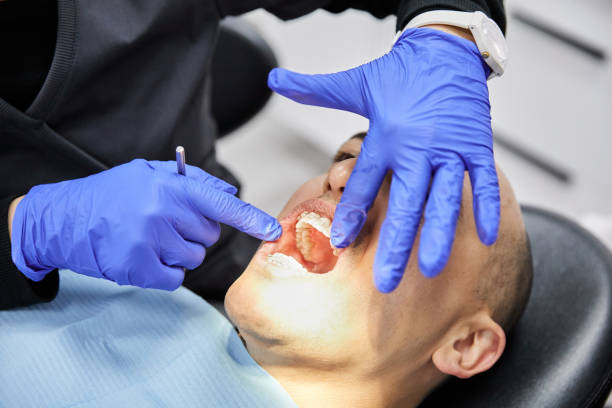 Best Emergency Wisdom Tooth Extraction in La Paloma, TX